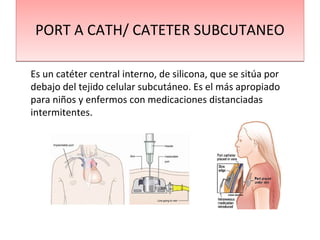 PORT A CATH/ CATETER SUBCUTANEOPORT A CATH/ CATETER SUBCUTANEO
Es un catéter central interno, de silicona, que se sitúa por
debajo del tejido celular subcutáneo. Es el más apropiado
para niños y enfermos con medicaciones distanciadas
intermitentes.
 