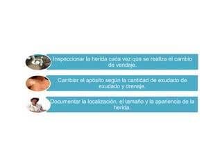 Inspeccionar la herida cada vez que se realiza el cambio
de vendaje.
Cambiar el apósito según la cantidad de exudado de
exudado y drenaje.
Documentar la localización, el tamaño y la apariencia de la
herida.
 