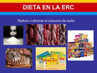 DIETA EN LA ERC 
Reducir o eliminar el consumo de sodio: 
 