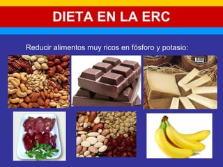 DIETA EN LA ERC 
Reducir alimentos muy ricos en fósforo y potasio: 
 