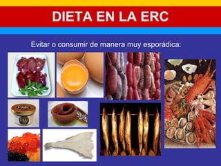 DIETA EN LA ERC 
Evitar o consumir de manera muy esporádica: 
 