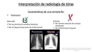 Interpretación de radiología de tórax
Características de una correcta Rx:
1. Penetración:
Adecuada
Ver las primeras 4 vertebras torácicas
Ver la tráquea hasta antes de la bifurcación
Excesiva
 Ver número excesivo de cuerpos
vertebrales
 Ver la bifurcación traqueal
Felson, Principios de radiología torácica. Sociedad Española de Radiología
Médica - SERAM. Advanced Trauma Life Support ATLS, Colegio Americano
de Cirujanos.
 