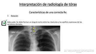 2. Rotación
Adecuada: Se debe formar un ángulo recto entre las clavículas y las apófisis espinosas de las
vertebras dorsales.
Interpretación de radiología de tórax
Características de una correcta Rx:
Felson, Principios de radiología torácica. Sociedad Española de Radiología
Médica - SERAM. Advanced Trauma Life Support ATLS, Colegio Americano
de Cirujanos.
 