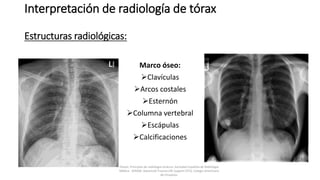 Interpretación de radiología de tórax
Estructuras radiológicas:
Marco óseo:
Clavículas
Arcos costales
Esternón
Columna vertebral
Escápulas
Calcificaciones
Felson, Principios de radiología torácica. Sociedad Española de Radiología
Médica - SERAM. Advanced Trauma Life Support ATLS, Colegio Americano
de Cirujanos.
 