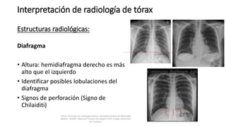 Diafragma
• Altura: hemidiafragma derecho es más
alto que el izquierdo
• Identificar posibles lobulaciones del
diafragma
• Signos de perforación (Signo de
Chilaiditi)
Interpretación de radiología de tórax
Estructuras radiológicas:
Felson, Principios de radiología torácica. Sociedad Española de Radiología
Médica - SERAM. Advanced Trauma Life Support ATLS, Colegio Americano
de Cirujanos.
 
