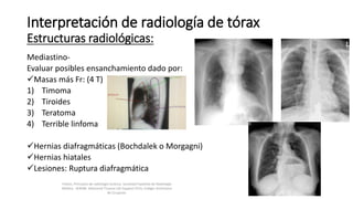 Mediastino-
Evaluar posibles ensanchamiento dado por:
Masas más Fr: (4 T)
1) Timoma
2) Tiroides
3) Teratoma
4) Terrible linfoma
Hernias diafragmáticas (Bochdalek o Morgagni)
Hernias hiatales
Lesiones: Ruptura diafragmática
Interpretación de radiología de tórax
Estructuras radiológicas:
Felson, Principios de radiología torácica. Sociedad Española de Radiología
Médica - SERAM. Advanced Trauma Life Support ATLS, Colegio Americano
de Cirujanos.
 