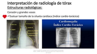 Corazón y grandes vasos
Evaluar tamaño de la silueta cardíaca (Indice cardio-torácico)
Interpretación de radiología de tórax
Estructuras radiológicas:
Felson, Principios de radiología torácica. Sociedad Española de Radiología
Médica - SERAM. Advanced Trauma Life Support ATLS, Colegio Americano
de Cirujanos.
 