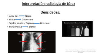 Interpretación radiología de tórax
Densidades:
• Aire/ Gas Negro
• Grasa Gris oscuro
• Tejidos blandos/ órganos Gris claro
• Metal/hueso Blanco
Felson, Principios de radiología torácica. Sociedad Española de Radiología
Médica - SERAM. Advanced Trauma Life Support ATLS, Colegio Americano
de Cirujanos.
 