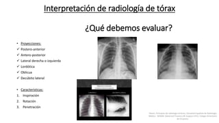 Interpretación de radiología de tórax
¿Qué debemos evaluar?
• Proyecciones:
 Postero-anterior
 Antero-posterior
 Lateral derecha o izquierda
 Lordótica
 Oblicua
 Decúbito lateral
• Características:
1. Inspiración
2. Rotación
3. Penetración
Felson, Principios de radiología torácica. Sociedad Española de Radiología
Médica - SERAM. Advanced Trauma Life Support ATLS, Colegio Americano
de Cirujanos.
 