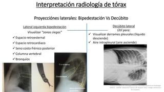 Interpretación radiología de tórax
Proyecciónes laterales: Bipedestación Vs Decúbito
Lateral izquierda bipedestación
Visualizar “zonas ciegas”
Espacio retroesternal
Espacio retrocardiaco
Seno costo-frénico posterior
Columna vertebral
Bronquios
Aorta
Decúbito lateral
Útil para:
 Visualizar derrames pleurales (líquido
desciende)
 Aire intrapleural (aire asciende)
Felson, Principios de radiología torácica. Sociedad Española de Radiología
Médica - SERAM. Advanced Trauma Life Support ATLS, Colegio Americano
de Cirujanos.
 