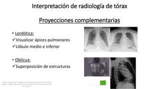 Interpretación de radiología de tórax
Proyecciones complementarias
• Lordótica:
Visualizar ápices pulmonares
Lóbulo medio e inferior
• Oblicua:
Superposición de estructuras
Felson, Principios de radiología torácica. Sociedad Española de Radiología
Médica - SERAM. Advanced Trauma Life Support ATLS, Colegio Americano
de Cirujanos.
 