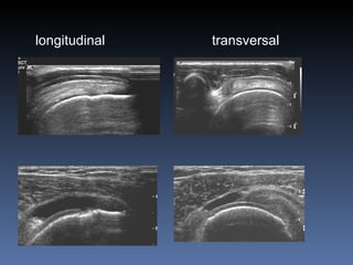 longitudinal transversal 