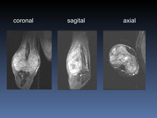 coronal   sagital axial 