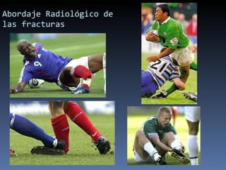 Abordaje Radiológico de las fracturas 
