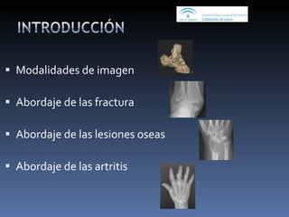 Modalidades de imagen Abordaje de las fractura Abordaje de las lesiones oseas Abordaje de las artritis 