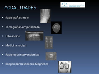 Radiografia simple Tomografia Computarizada Ultrasonido Medicina nuclear Radiologia Intervensionista  Imagen por Resonancia Magnetica 