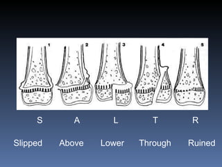 S   A  L   T   R Slipped  Above  Lower   Through  Ruined 