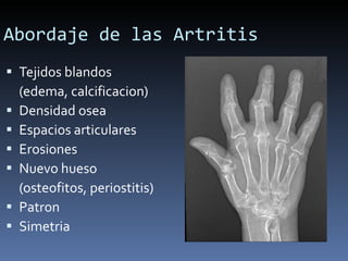 Abordaje de las Artritis Tejidos blandos  (edema, calcificacion) Densidad osea  Espacios articulares Erosiones Nuevo hueso  (osteofitos, periostitis) Patron Simetria 