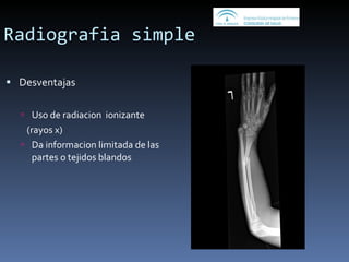 Radiografia simple Desventajas Uso de radiacion  ionizante  (rayos x) Da informacion limitada de las partes o tejidos blandos  