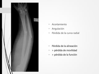  Acortamiento
 Angulación
 Pérdida de la curva radial
 Pérdida de la alineación
 > pérdida de movilidad
 > pérdida de la función
 