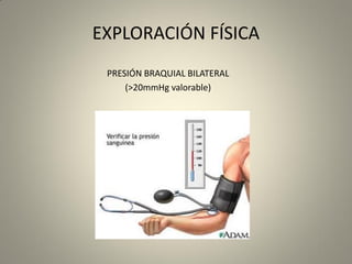 EXPLORACIÓN FÍSICA
PRESIÓN BRAQUIAL BILATERAL
(>20mmHg valorable)
 