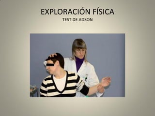 EXPLORACIÓN FÍSICA
TEST DE ADSON
 
