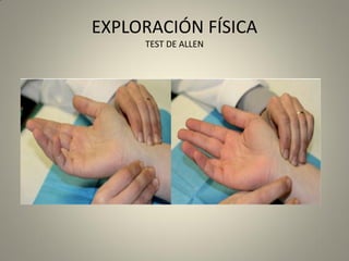 EXPLORACIÓN FÍSICA
TEST DE ALLEN
 
