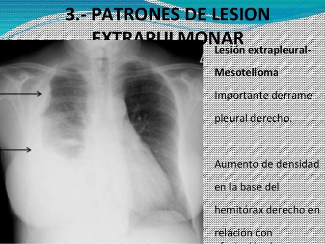 radiologia de torax