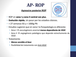 Agressive Rop Sesion rop | PPTX