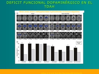 Sesión TDAH 2011 | PPT