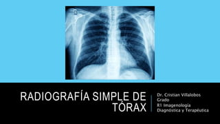 RADIOGRAFÍA SIMPLE DE
TÓRAX
Dr. Cristian Villalobos
Grado
R1 Imagenología
Diagnóstica y Terapéutica
 