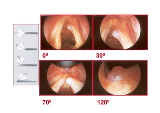 0000
303000
707000
12012000
 