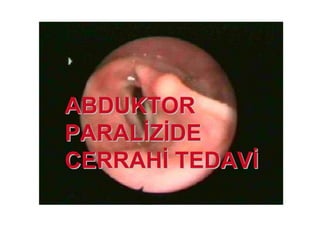 AABDUKTORBDUKTOR
PARALPARAL ZZ DEDE
CERRAHCERRAH TEDAVTEDAV
 