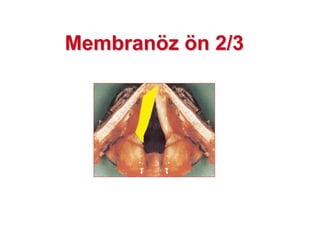 MembranMembranöözz öön 2/3n 2/3
 