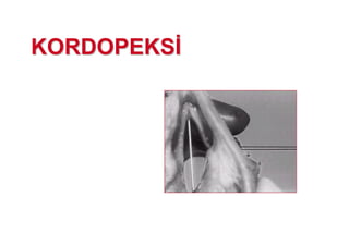 KORDOPEKSKORDOPEKS
 