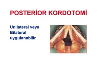 POSTERPOSTER OR KORDOTOMOR KORDOTOM
UnilateralUnilateral veyaveya
BilateralBilateral
uygulanabiliruygulanabilir
 