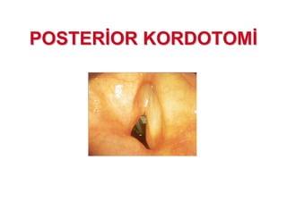 POSTERPOSTER OR KORDOTOMOR KORDOTOM
 