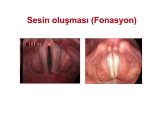 SSesin oluesin olu((masmas ((FonasyonFonasyon))
 