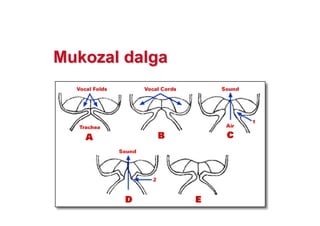 MuMukkoozzalal dalgadalga
 