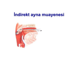 ndirendirektkt ayna muayenesiayna muayenesi
 