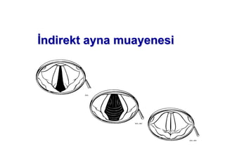 ndirendirektkt ayna muayenesiayna muayenesi
 