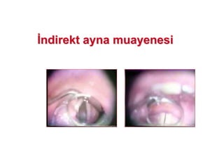 ndirendirektkt ayna muayenesiayna muayenesi
 