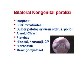 BilateralBilateral KongenitalKongenital paraliziparalizi
•• diopatikdiopatik
•• SSSSSS immatimmatüüritesiritesi
•• BulberBulber patolojiler (patolojiler (kernkern ikterusikterus,, poliopolio))
•• ArnoldArnold ChiariChiari
•• PlatybasiPlatybasi
•• HipoksiHipoksi,, hemorajihemoraji, CP, CP
•• HidrosefaliHidrosefali
•• MeningomyeloselMeningomyelosel
 