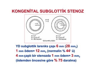 YDYD subglottiksubglottik larenkslarenks ççapap 66 mmmm ((2828 mmmm22))
11 mmmm öödem=dem= 1212 mmmm22 (normalin %(normalin % 4444’’ üü))
44 mmmm ççaplapl birbir stenozdastenozda 11 mmmm öödem=dem= 33 mmmm22
((öödemdendemden ööncesine gncesine göörere % 75% 75 daralma)daralma)
KONGENKONGEN TAL SUBGLOTTTAL SUBGLOTT K STENOZK STENOZ
 
