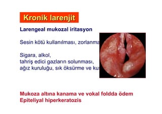 Larengeal mukozal iritasyon
Sesin kötü kullan lmas , zorlanmas
Sigara, alkol,
tahri# edici gazlar n solunmas ,
a! z kurulu!u, s k öksürme ve kusma
Mukoza alt na kanama ve vokal foldda ödem
Epiteliyal hiperkeratozis
Kronik larenjitKronik larenjit
 