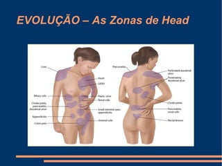 EVOLUÇÃO – As Zonas de Head
 