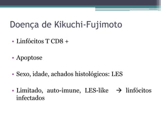Doença de Kikuchi-Fujimoto
• Linfócitos T CD8 +
• Apoptose
• Sexo, idade, achados histológicos: LES

• Limitado, auto-imune, LES-like
infectados

 linfócitos

 