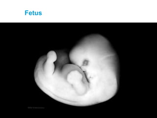 Fetus
 