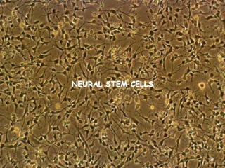 17
NEURAL STEM CELLS
9
 