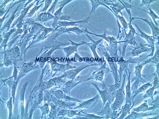 MESENCHYMAL STROMAL CELLS
 